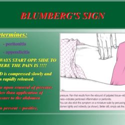 The nurse would assess for positive blumberg sign how